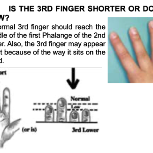 040_07 Third finger shorter